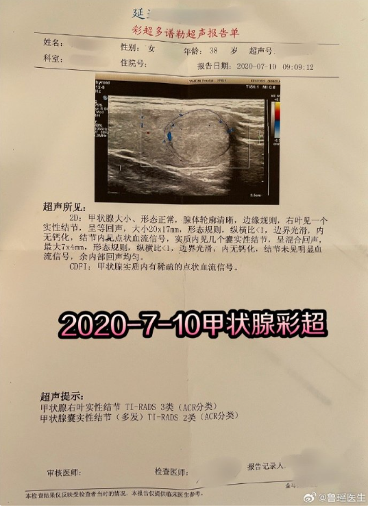 恒运资本配资 甲状腺结节消融术后2年，为什么结节不缩反长？