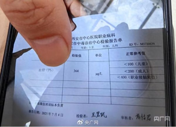 鸿岳资本配资 铅中毒离我们有多远?速查这些隐患 日常防范不容忽视